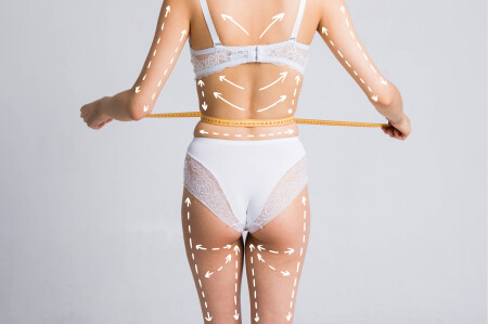 Cellulite removal scheme on body. White markings arrow young woman meter. Plastic surgery on back